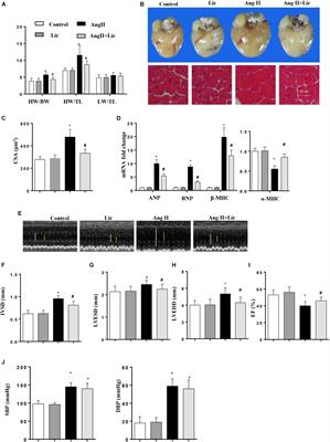 The Glp-1 Analog Liraglutide Protects Against Angiotensin II and Pressure Overload-Induced Cardiac Hypertrophy via PI3K/Akt1 and AMPKa Signaling